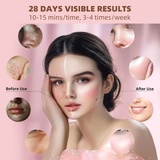 LED маска за лице со светлосна терапија - Image 4